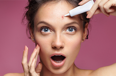 acne treatment in nepal